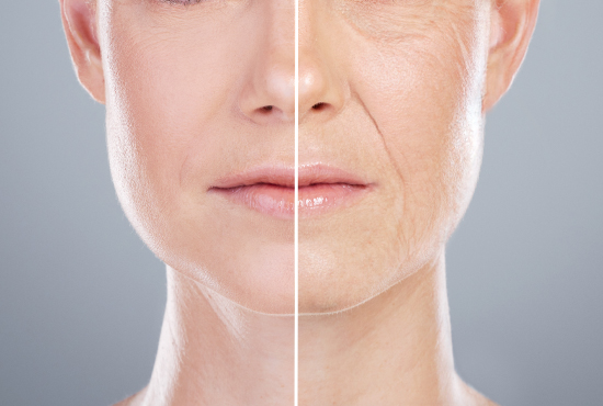 Comblement acide hyaluronique à Djerba