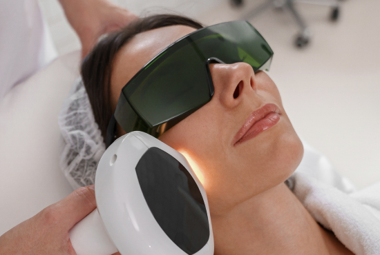 Épilation Laser – Pilosité Excessive (Ovaires Polykystiques) à Djerba